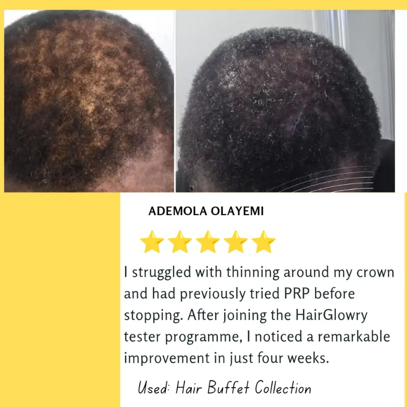 Ayura Nourishing Hair and Scalp Serum for Healthy Hair - Image 5